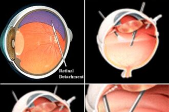 Mavs’ Davis Undergoes Surgery to Repair Detached Retina